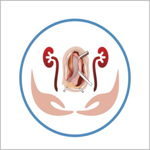 Dr Vipin Sharma- MBBS,MS, MCh Urology, DNB Urology